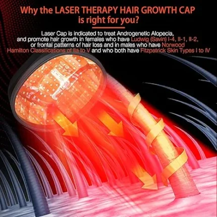 Laser Cap (FDA Cleared), Professional Medical Grade Lasers Hair Growth Treatment Product for Men & Women, Red Light Therapy for Hair Growth, Treat Alopecia