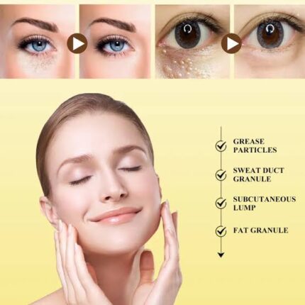 Milai remover