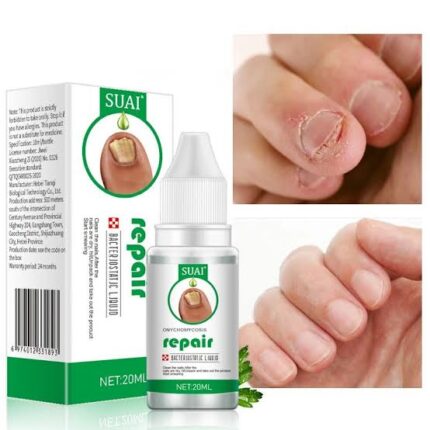 Toenail Fungus Treatment